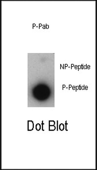 Phospho-P21CIP1(T57) Antibody