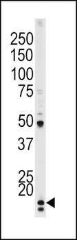 Phospho-P21CIP1(T145) Antibody