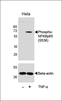 Phospho-NFKB(S536) Antibody