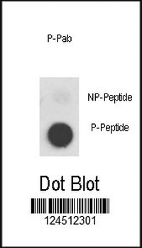 Phospho-MET(Y1356) Antibody