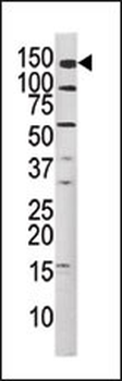 Phospho-MET(Y1349) Antibody