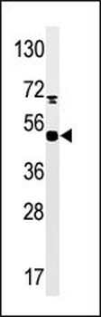 Phospho-MAPKAPK5(S93) Antibody
