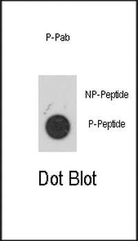 Phospho-MAPKAPK2(S272) Antibody
