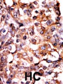 Phospho-MAPKAPK2(S272) Antibody