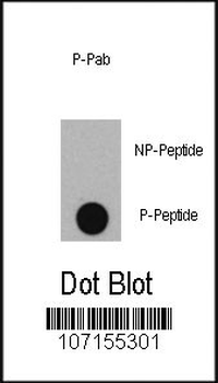 Phospho-INSR(Y1361) Antibody