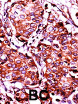 Phospho-INSR(Y1361) Antibody