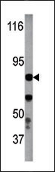 Phospho-IKKb(Y199) Antibody