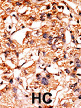 Bi-Phospho-GSK3B(S21/29) Antibody