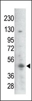 Bi-Phospho-GSK3B(S21/29) Antibody