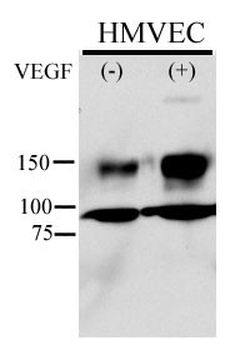 Phospho-KDR/FLK1(Y996) Antibody