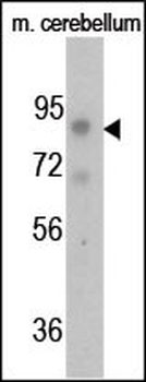 Phospho-FGFR(Y766) Antibody