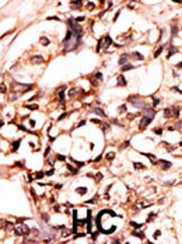 Phospho-DAXX(S213) Antibody