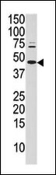 Phospho-cJun(S63) Antibody