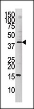 Phospho-cJun(S63) Antibody