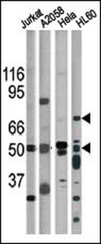 Phospho-CHK1(S317) Antibody