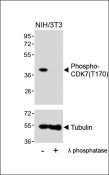 Phospho-CDK7(T170) Antibody