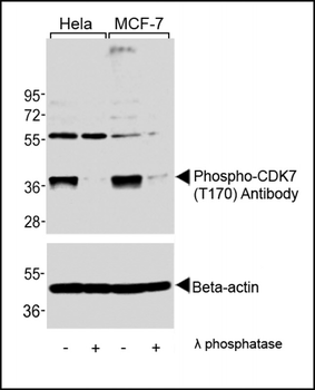 Phospho-CDK7(T170) Antibody