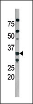 Phospho-Cdk2(T160) Antibody