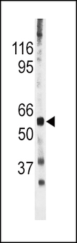 Phospho-CDC25A(S278) Antibody