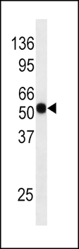 Phospho-CDC25A(S124) Antibody