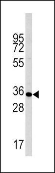 Phospho-Caspase 6(S257) Antibody