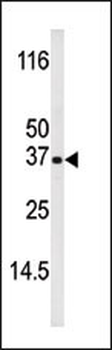 Phospho-Bik(T33) Antibody