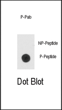 Phospho-Bad(S99) Antibody