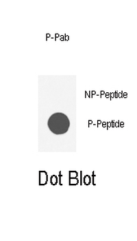 Phospho-AKT1(S129) Antibody