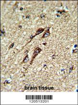 ATP5B Antibody (Center)