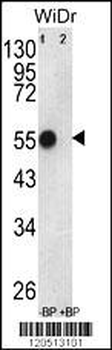 ATP5B Antibody (Center)