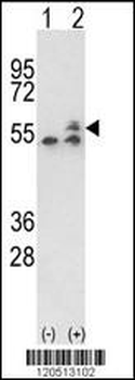 ATP5B Antibody (Center)