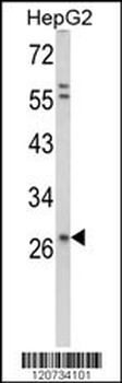 CD138 Antibody (C-term K281)