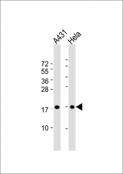PPIA Antibody (N-term)