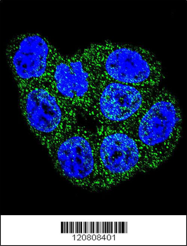 GSTP1 Antibody (C-term)