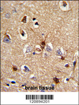 PRDX6 Antibody (C-term)