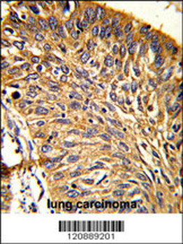 PRDX3 Antibody (N-term)