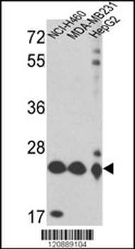 PRDX3 Antibody (N-term)