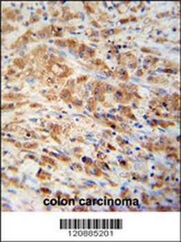 PRDX1 Antibody (Center)