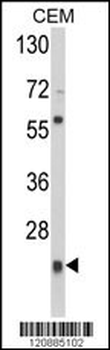 PRDX1 Antibody (Center)