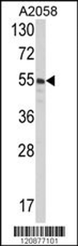 PDIA3 Antibody (C-term)