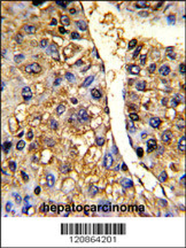 TUFM Antibody (N-term)