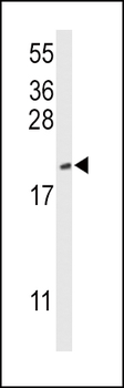 CFL1 Antibody (Center)