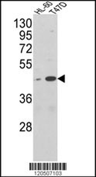 AHSA1 Antibody (N-term)