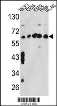 CCT3 Antibody (Center)