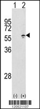 CCT3 Antibody (Center)