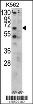 CCT3 Antibody (C-term)