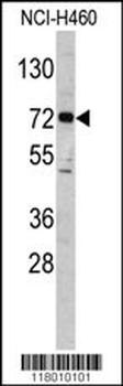 ELP2 Antibody (C-term)