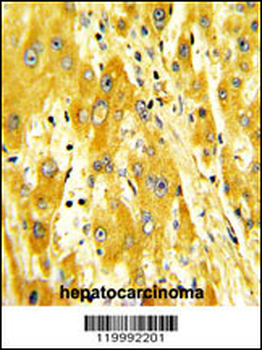 CD36 Antibody (Center)