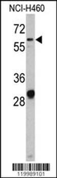 CD166 Antibody (N-term)