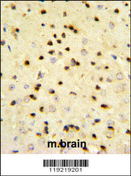 EBP1 Antibody (Center)